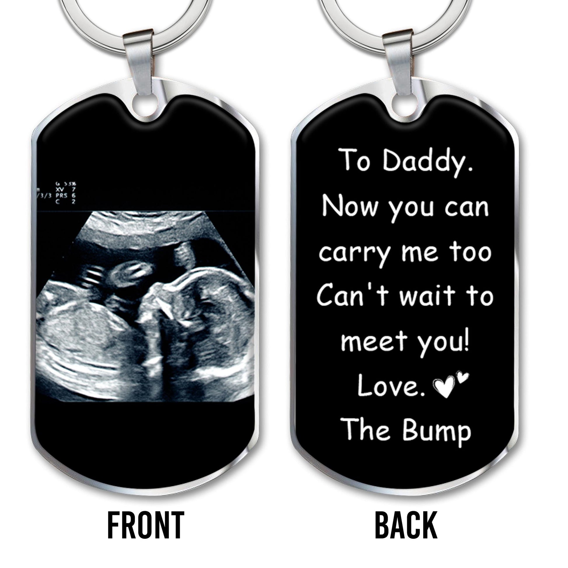 Can't Wait To Meet You Love The Bump Ultrasound Image