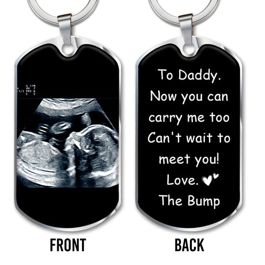 Can't Wait To Meet You Love The Bump Ultrasound Image