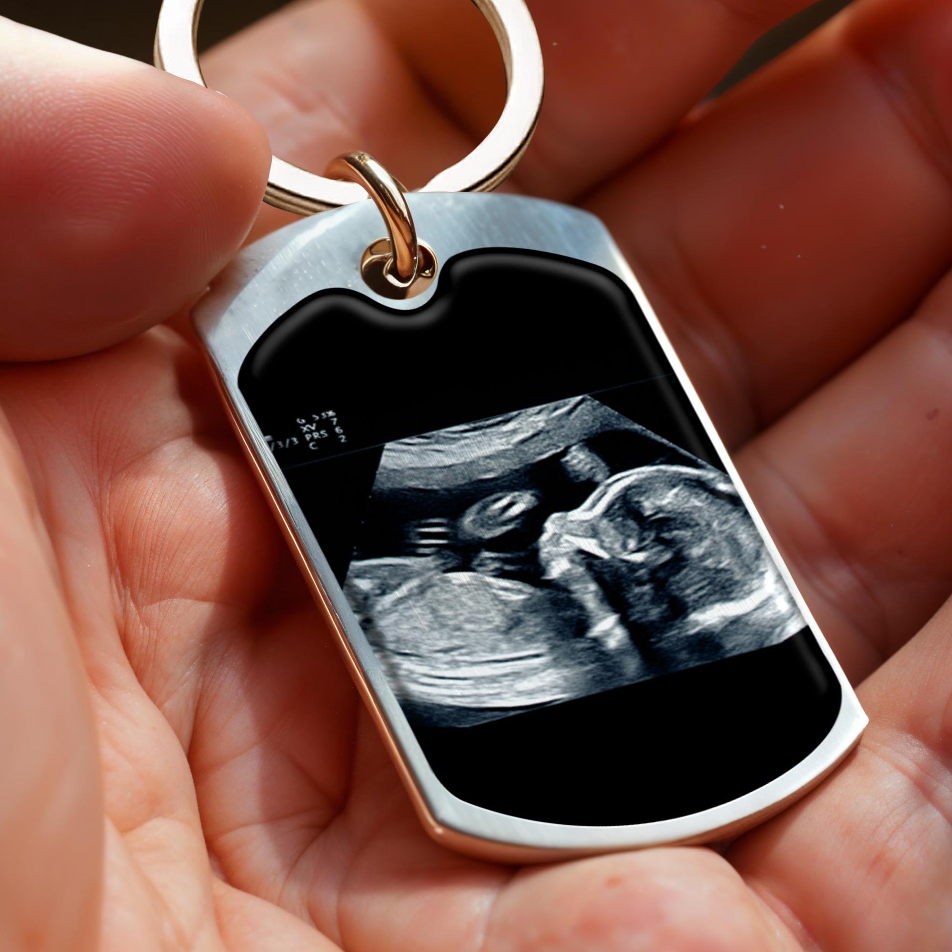 Can't Wait To Meet You Love The Bump Ultrasound Image