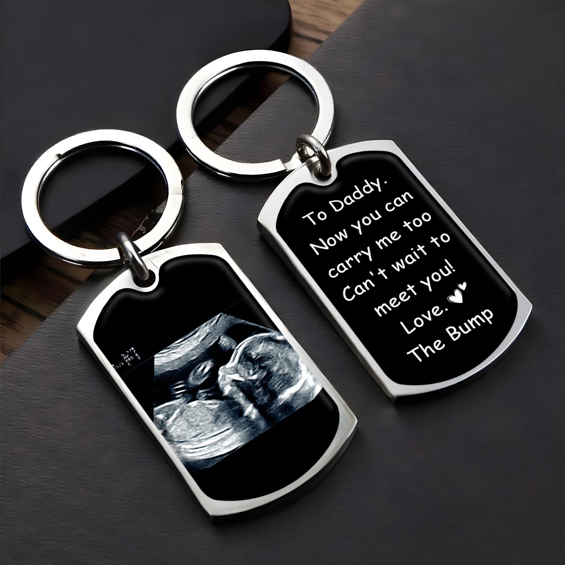 Can't Wait To Meet You Love The Bump Ultrasound Image