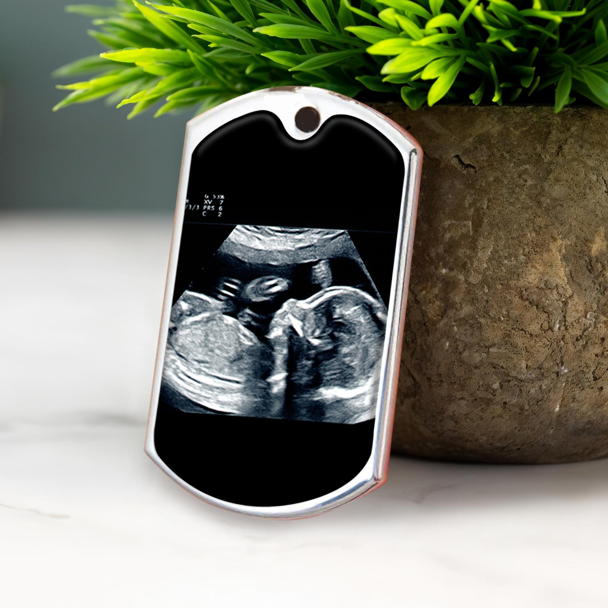 Can't Wait To Meet You Love The Bump Ultrasound Image