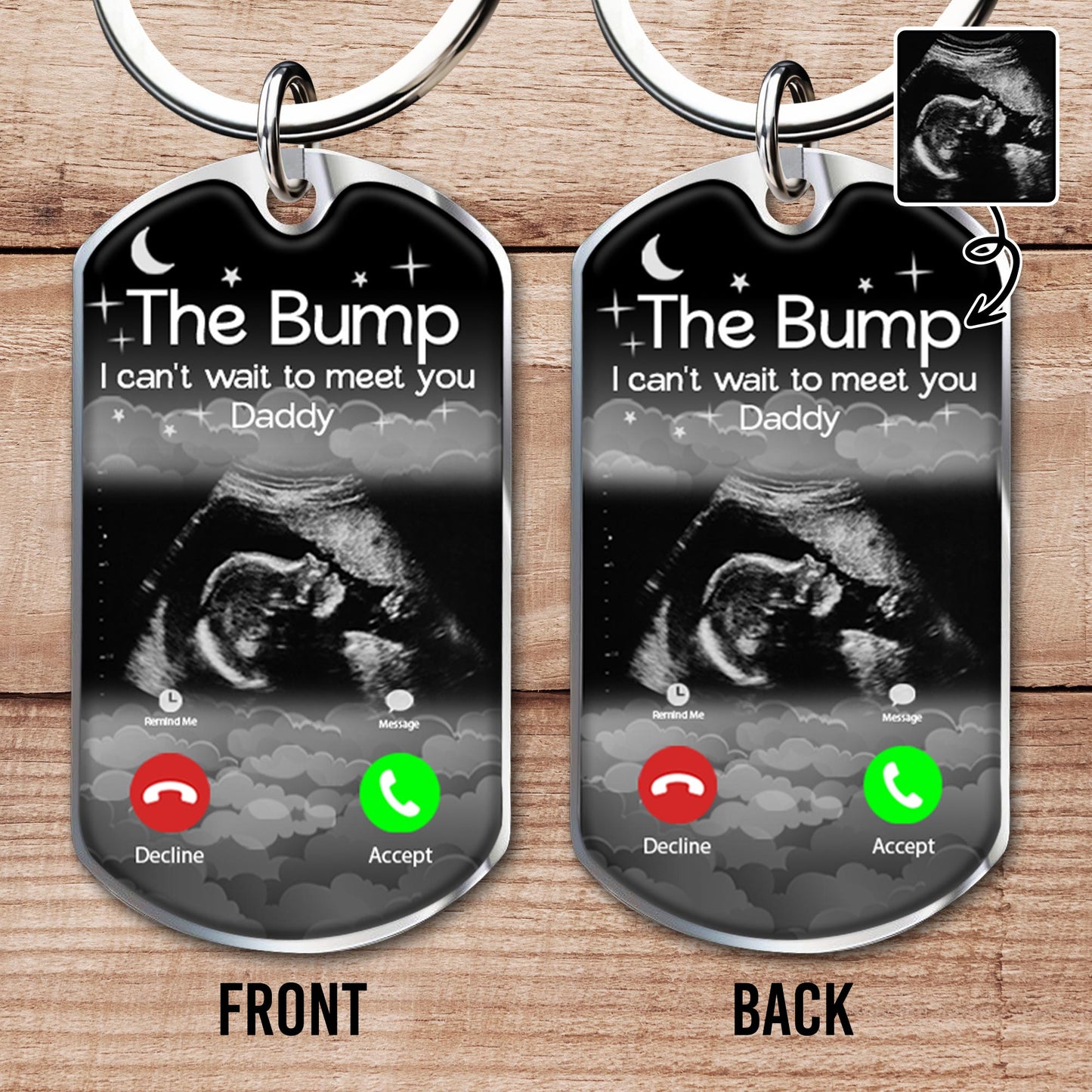 The Bump I can't wait to meet you Daddy, Ultrasound and Smartphone Interface