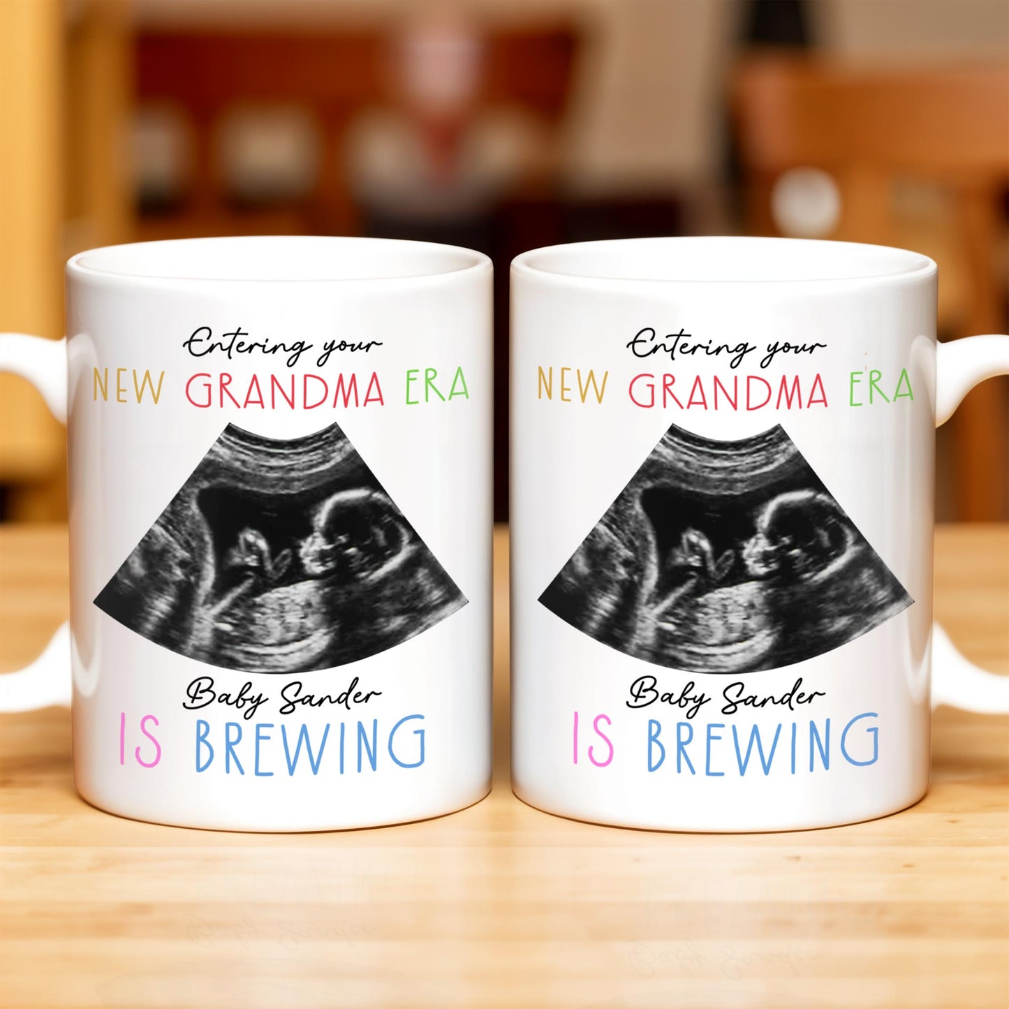 Entering Your New Grandma Era, Baby Sander Is Brewing, Ultrasound Image