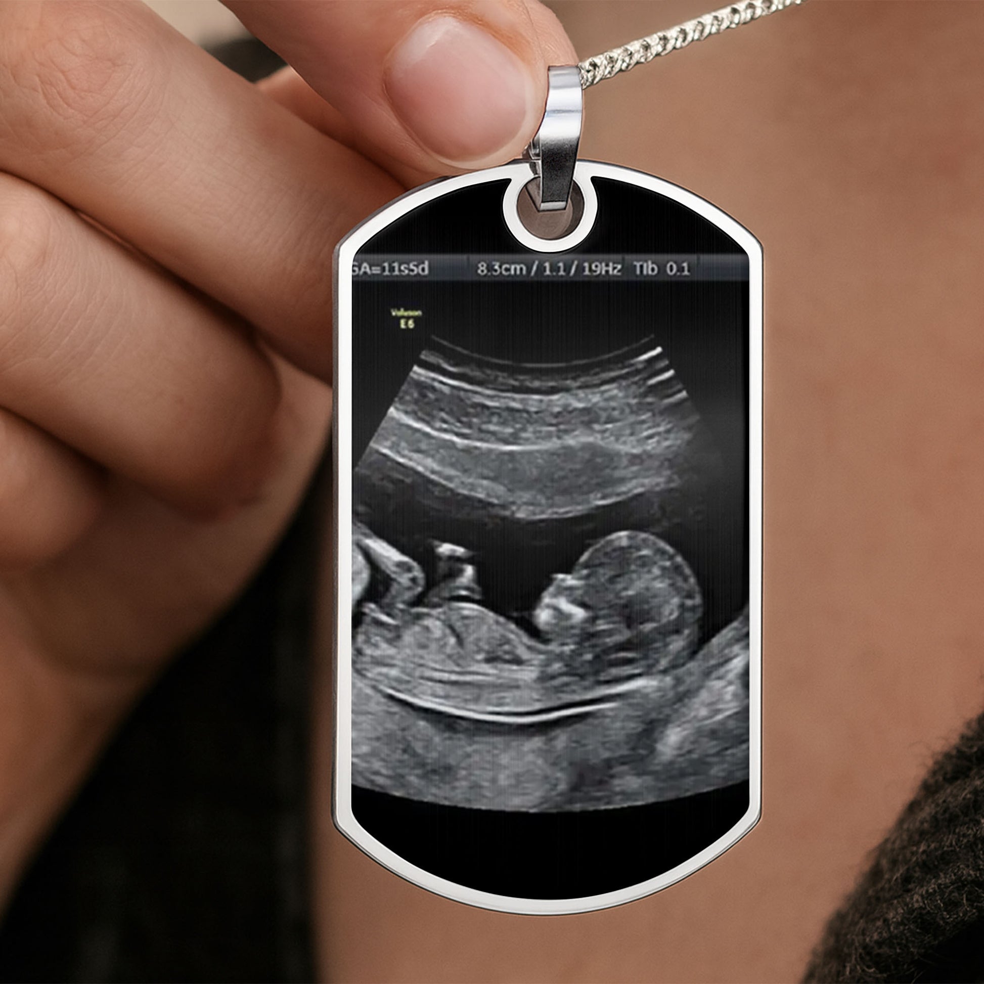 Stay Safe Daddy, I'll Be In Your Arms Soon, Ultrasound Image