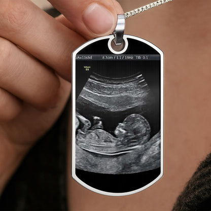 Stay Safe Daddy, I'll Be In Your Arms Soon, Ultrasound Image