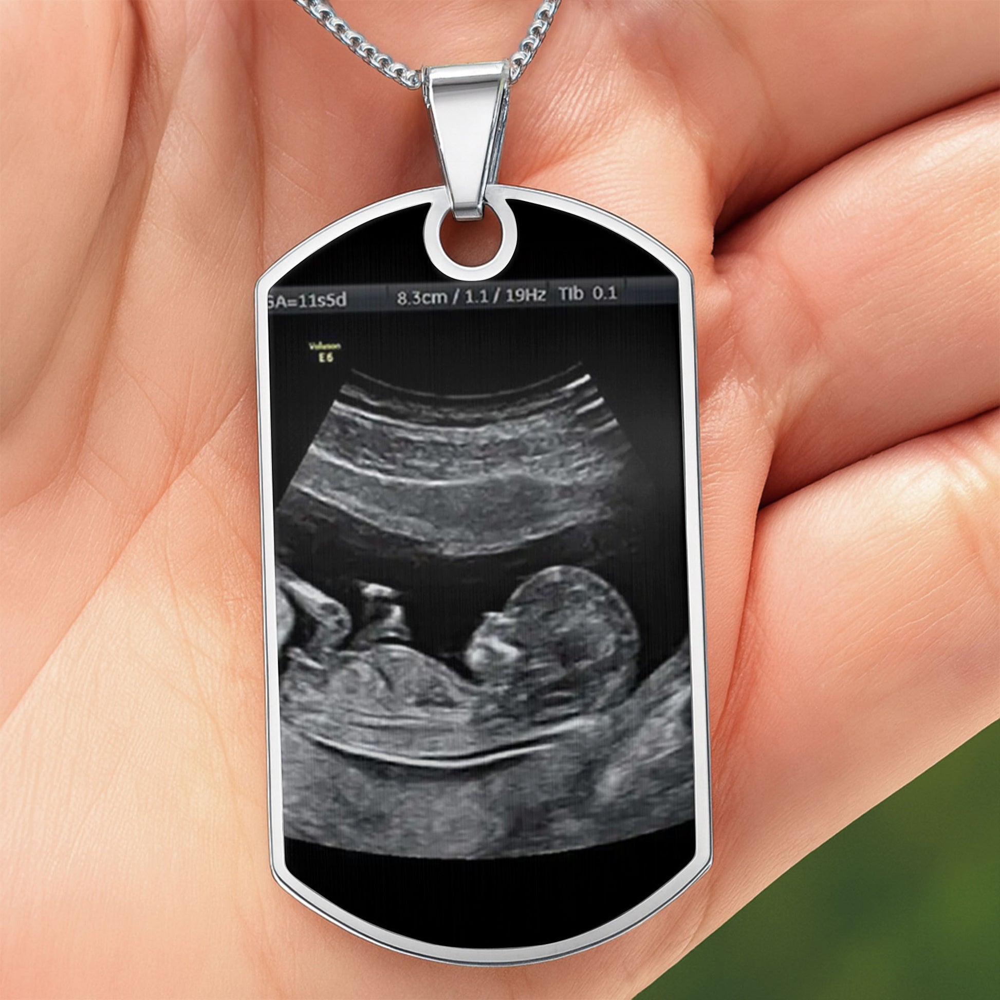 Stay Safe Daddy, I'll Be In Your Arms Soon, Ultrasound Image