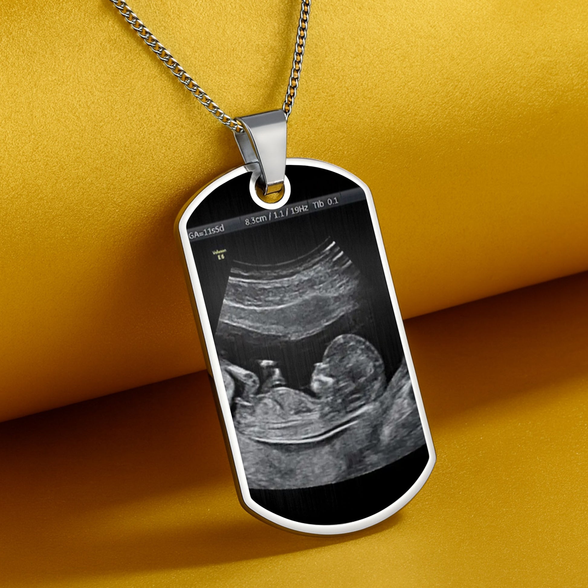 Stay Safe Daddy, I'll Be In Your Arms Soon, Ultrasound Image