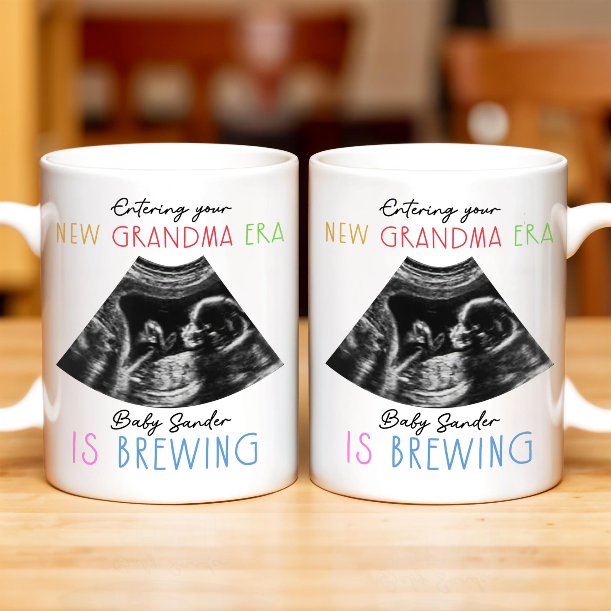 Entering Your New Grandma Era, Baby Sander Is Brewing, Ultrasound Image