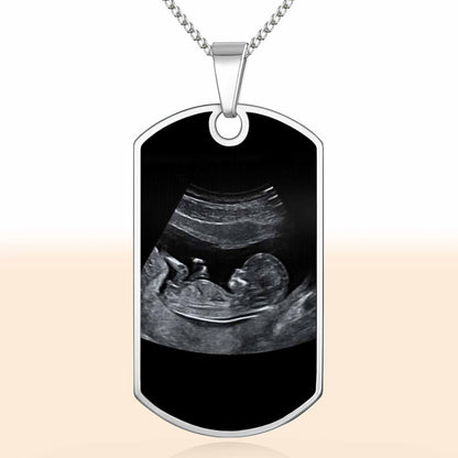 To Daddy Now You Can Carry Me Too, Ultrasound And Heart