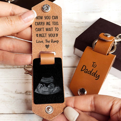 Now You Can Carry Me Too, Love The Bump